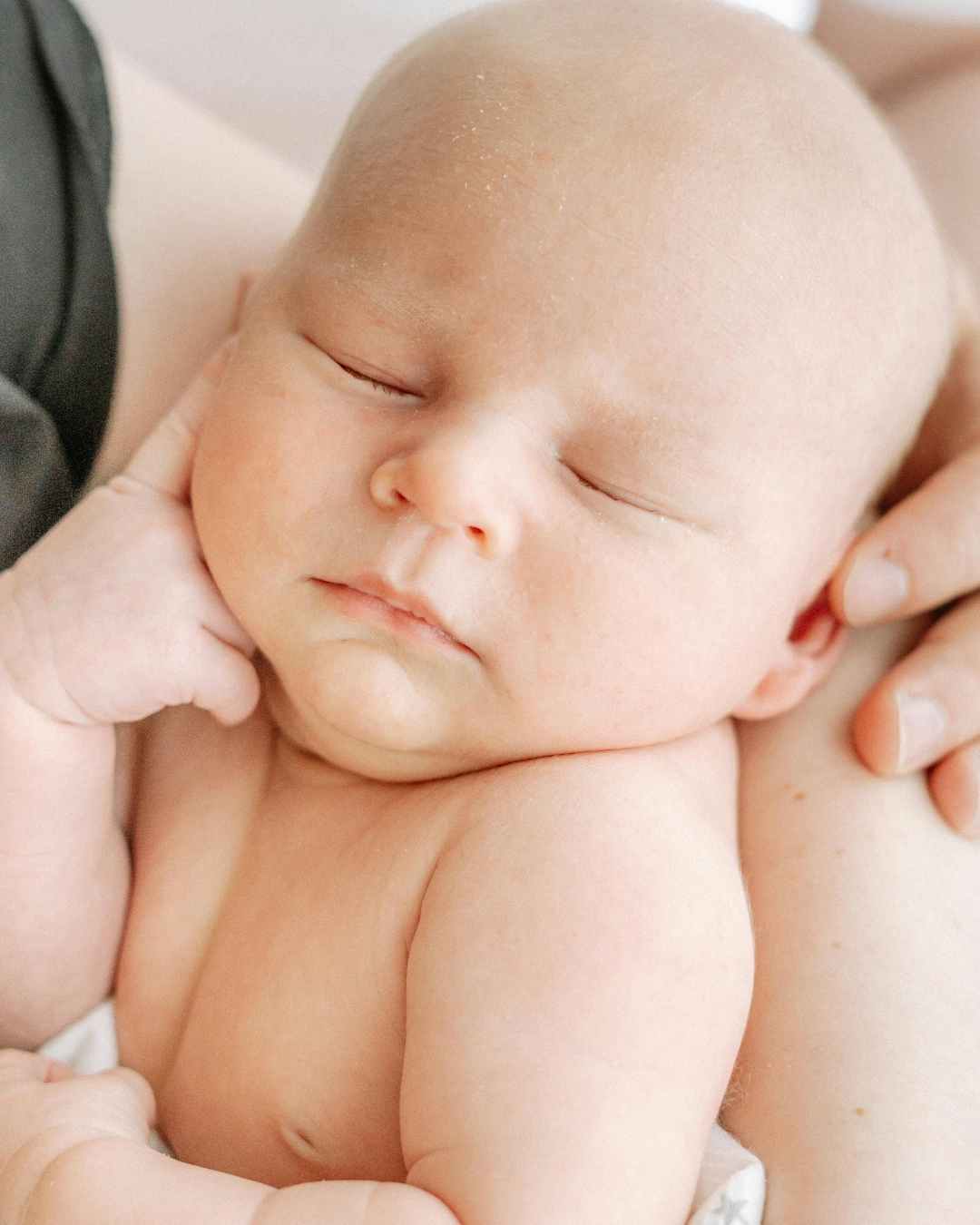 BÉBÉ TOUCHÉ PAR LA  DERMITE ATOPIQUE BOPLUME DERMATOLOGIE