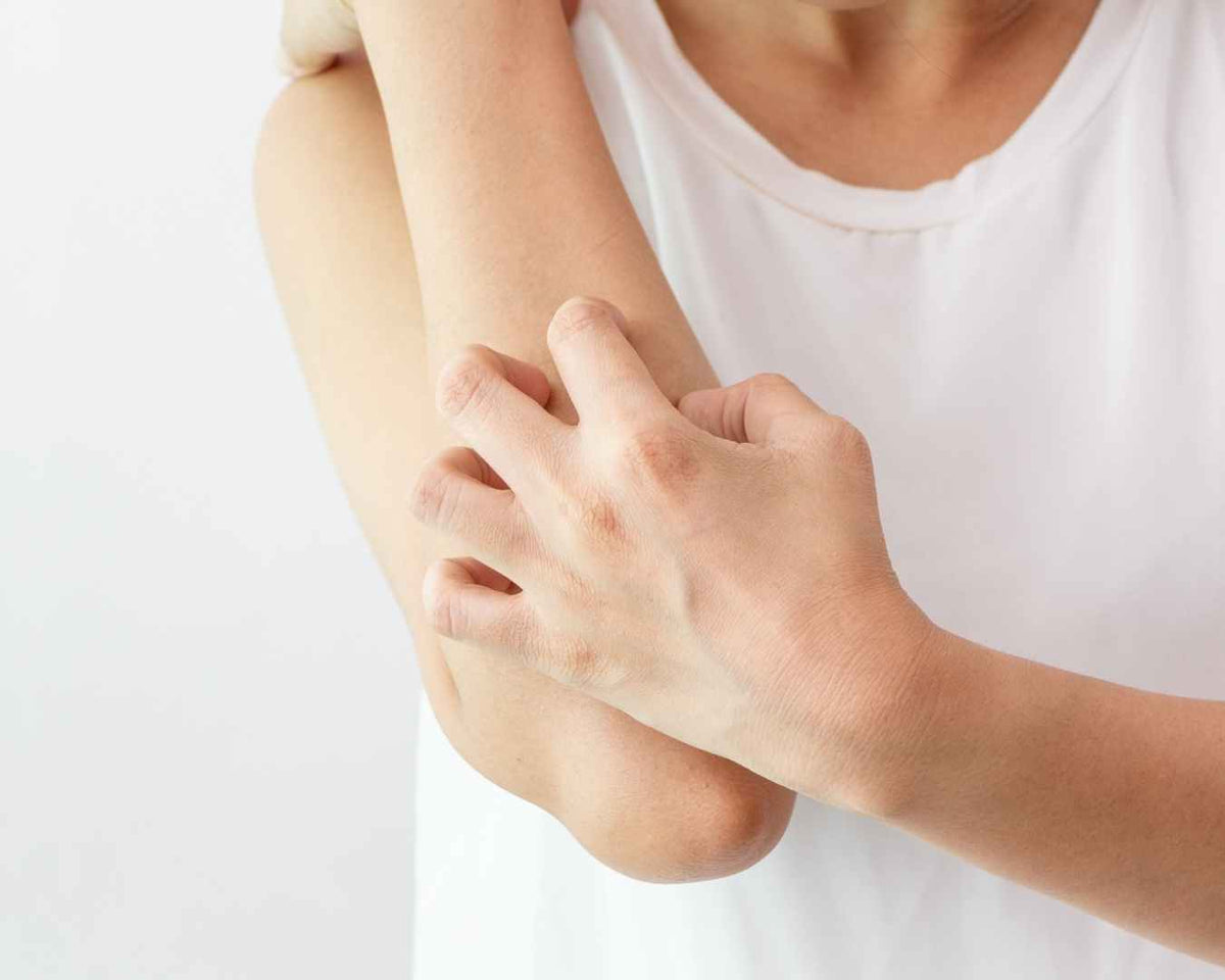 Les différents types d’eczéma