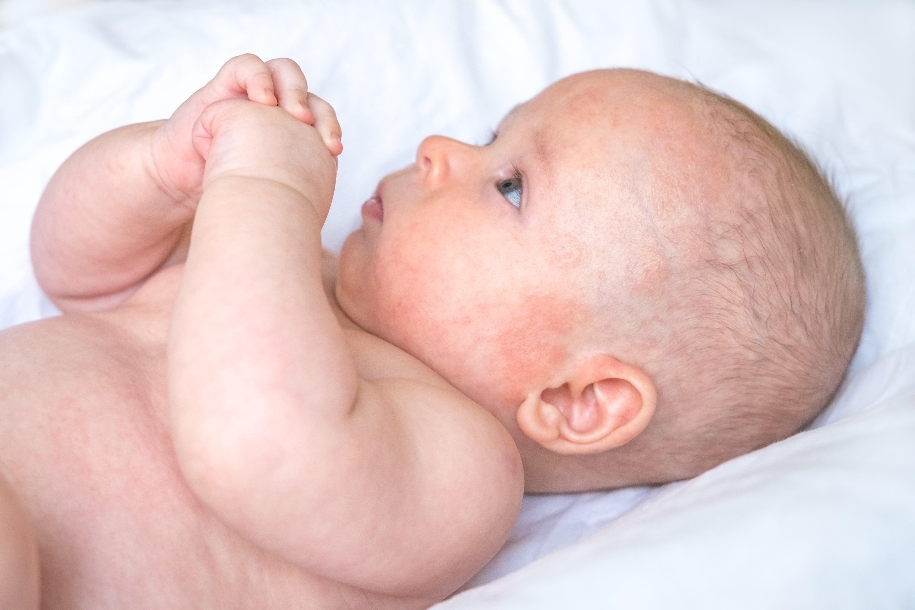 Bébé microbiome déséquilibré - Boplume Dermatologie