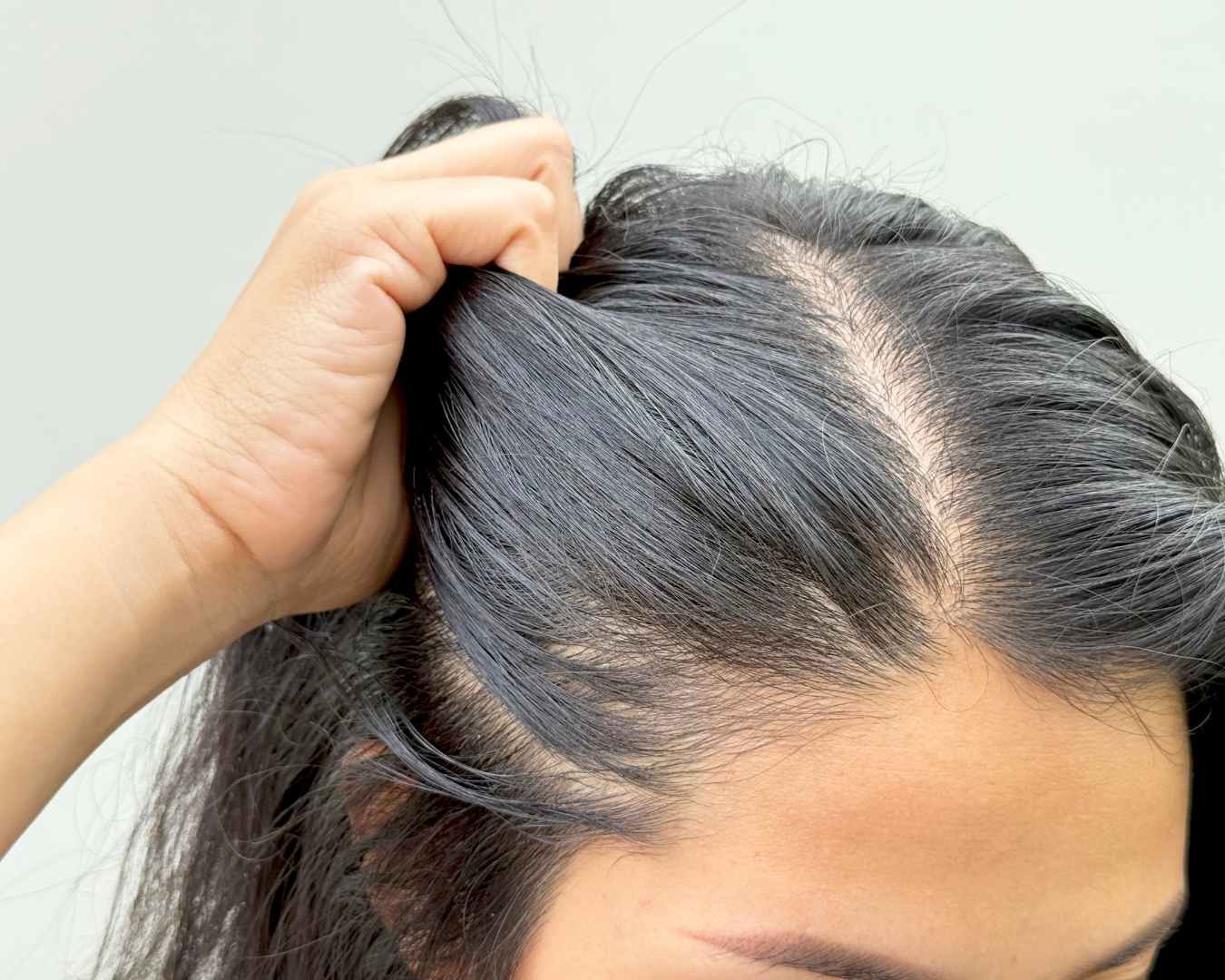 CUIR CHEVLU SENSIBLE ET  IRRITÉ BOPLUME DERMATOLOGIE